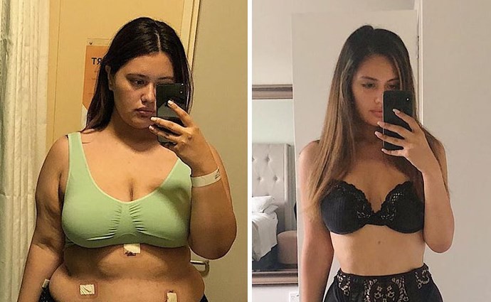 La joven que bajó 68 kilos y muestra cómo le quedó el cuerpo en Instagram | Curiosidades