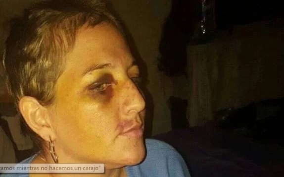 El calvario de Betiana: su ex pareja la golpeó brutalmente y le cortó el pelo | Actualidad