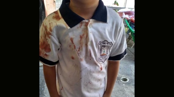 La terrible foto con la que una madre denunció el bullying que sufre su hijo en la escuela | Internacionales