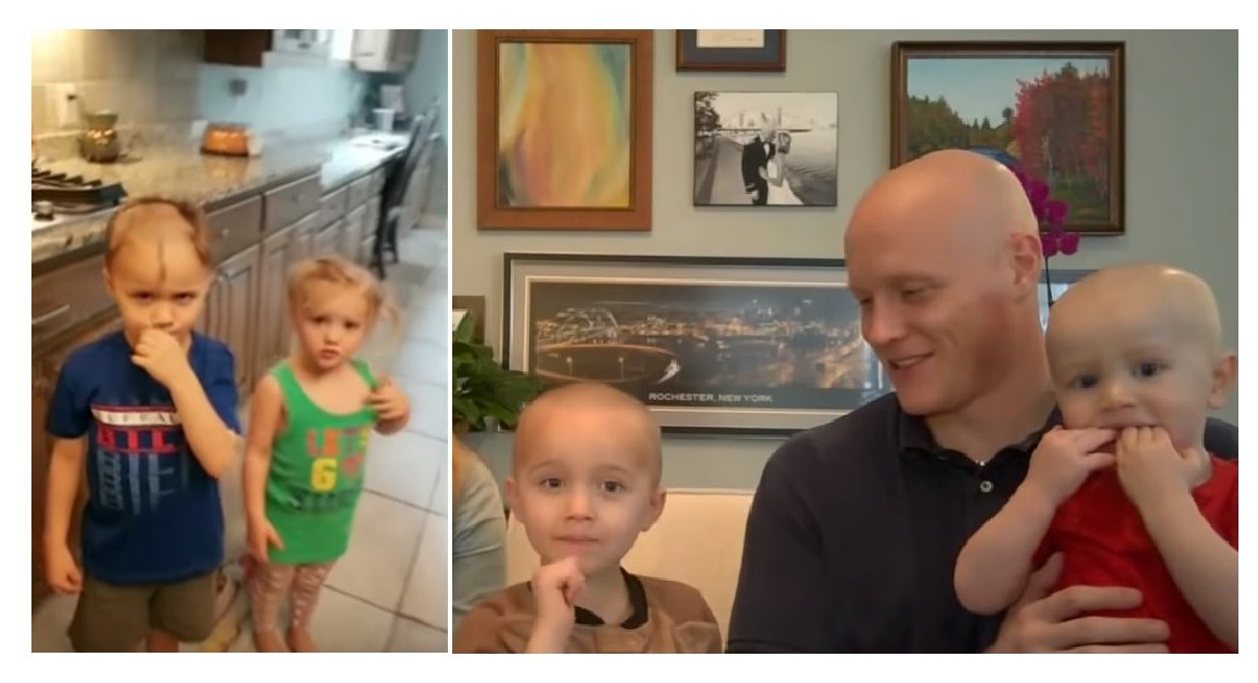 Hermanitos rapados: el día después de la travesura viral | Redes