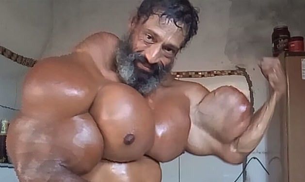 La terrible historia de vida del "Hulk brasileño": se inyecta aceite en los músculos | Curiosidades