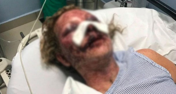 El terrible relato de la mujer que sobrevivió al salvaje ataque de un hombre en Punta Cana | Internacionales