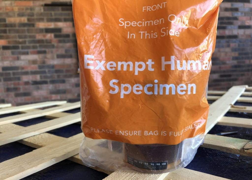 Compró unas cortinas de baño por Internet, pero recibió a cambio una muestra de orina | Redes