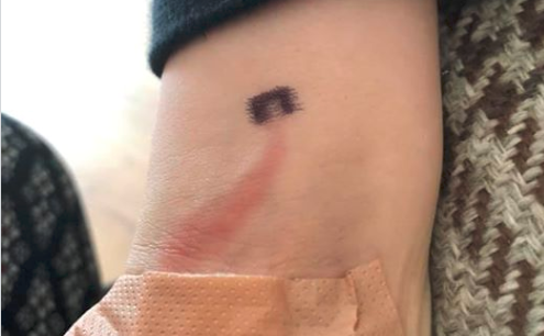 Una madre salvó la vida de su hijo por un detalle de su brazo | Internacionales