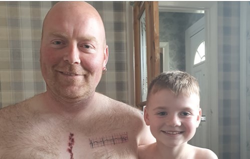 El padre que se tatuó la cicatriz que tiene su hijo por una operación | Curiosidades