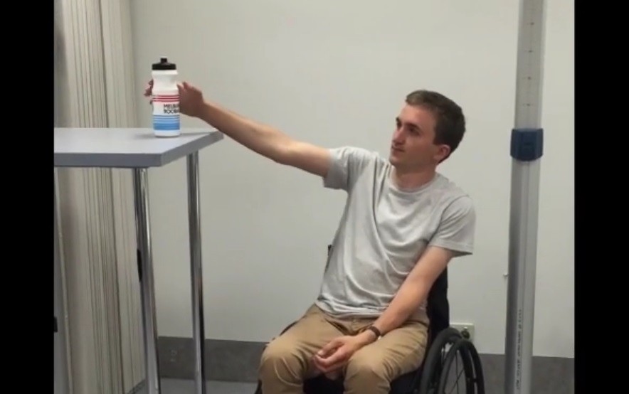 Transferencia de nervios y tendones: 13 personas tetrapléjicas pudieron volver a usar sus brazos | Internacionales