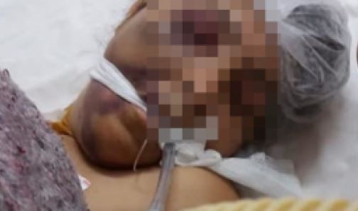 Denuncian a una ONG de ayuda a personas con discapacidad por maltrato a los internos | Actualidad