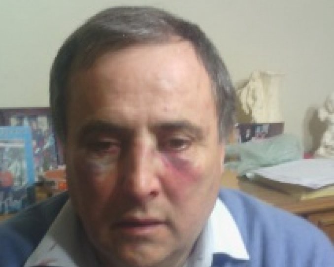 Brutal agresión de un padre y su hijo a director de una escuela | Actualidad