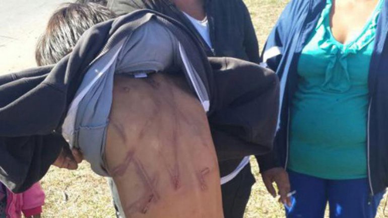 Lastimó a sus hijos porque perdieron la tarjeta del plan social | Actualidad