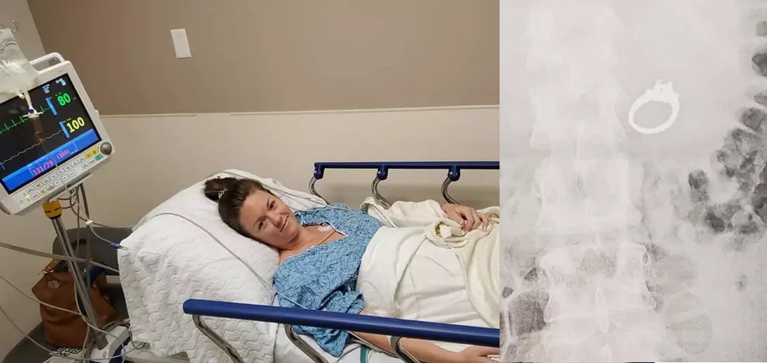 Soñó que se tragaba su anillo de compromiso, despertó y se lo había tragado | Redes