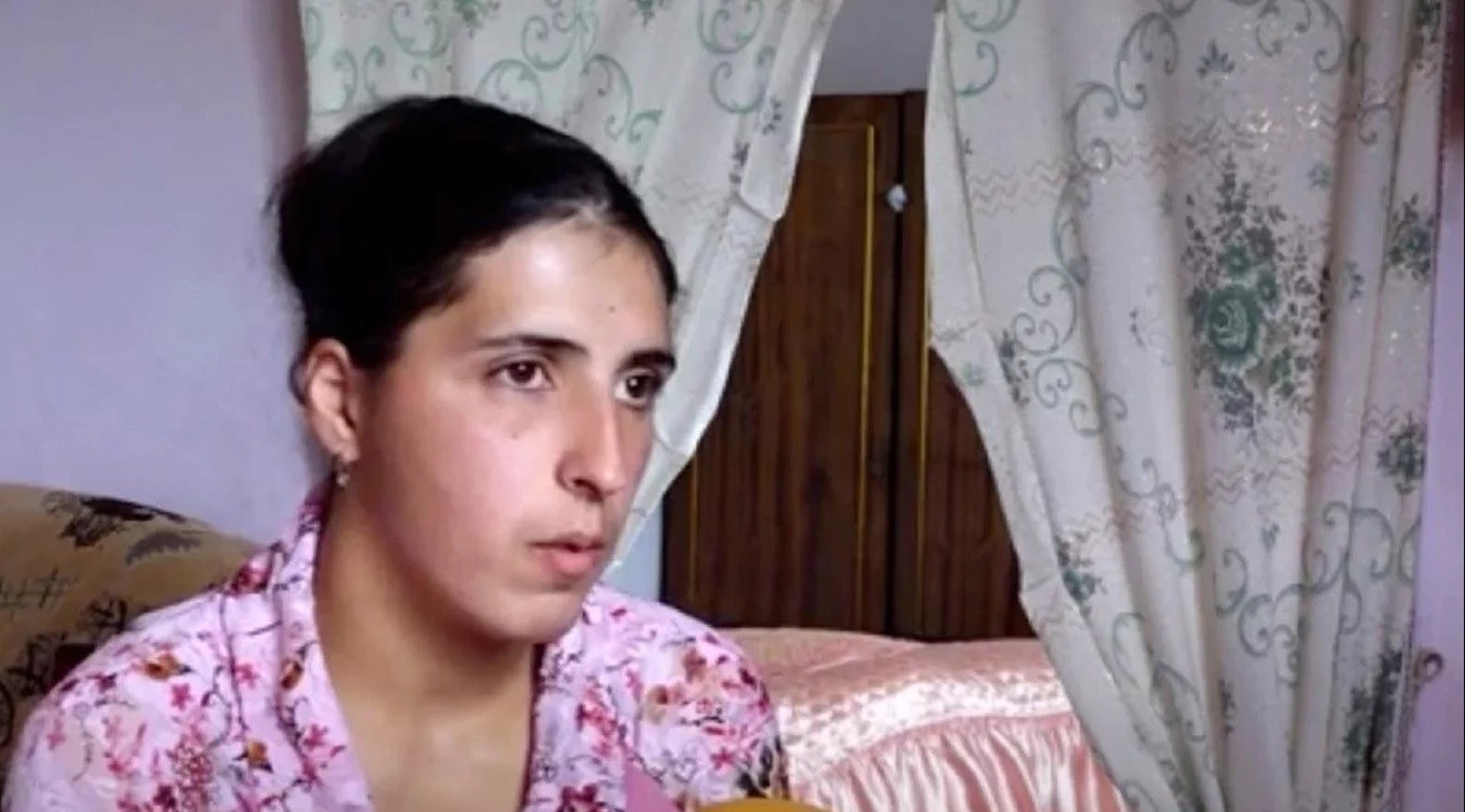 Una rara condición hace que una mujer llore "lágrimas de cristal" | Curiosidades