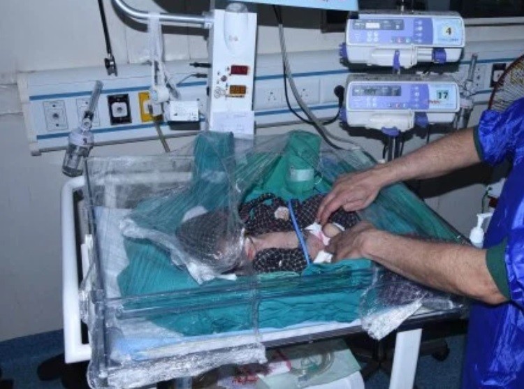 Mejora la beba que encontraron enterrada cuando sepultaban a una fallecida | Internacionales