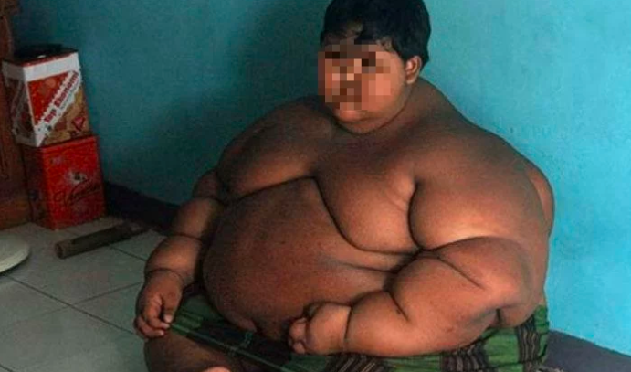 Video: el antes y después del nene que era considerado "el más obeso del mundo" | Curiosidades