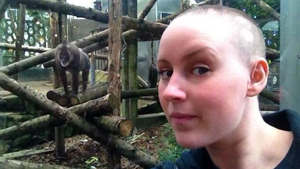 La historia de la joven que se quedó pelada por culpa del estrés | Curiosidades