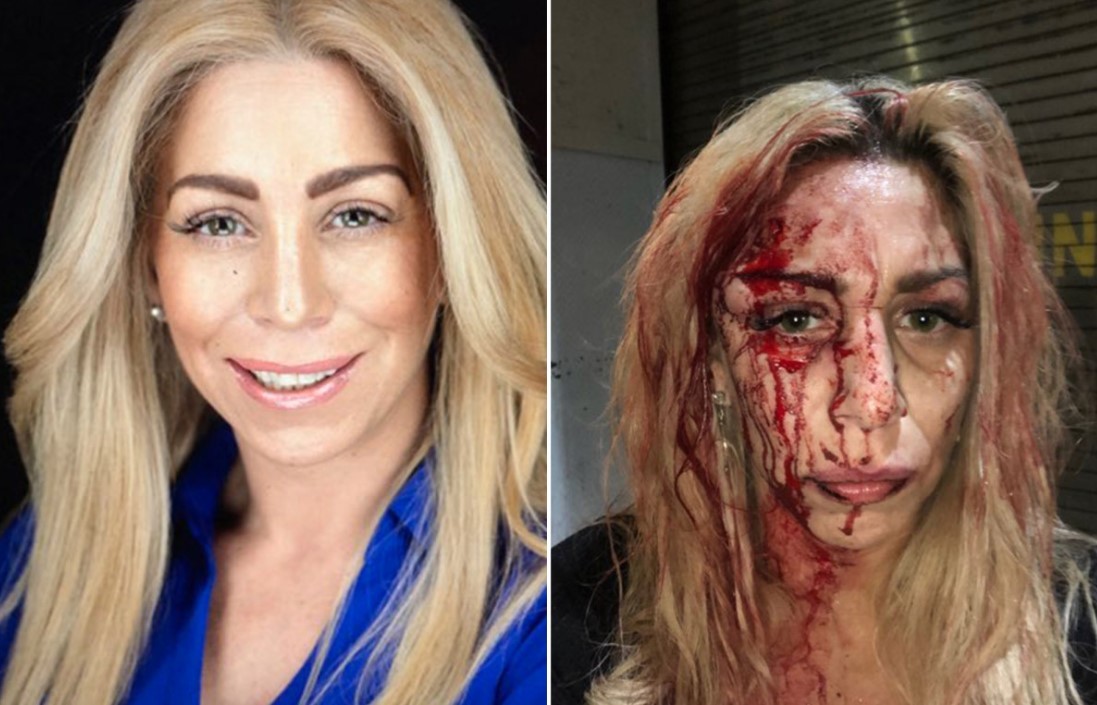 Feroz ataque racista a dos modelos en un bar de Nueva York | Internacionales