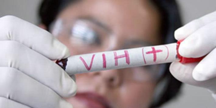 Descubren método para eliminar células con infección latente de VIH | Actualidad