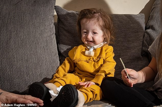 El calvario de la nena de 2 años que sufre "la enfermedad de Benjamin Button" | Curiosidades