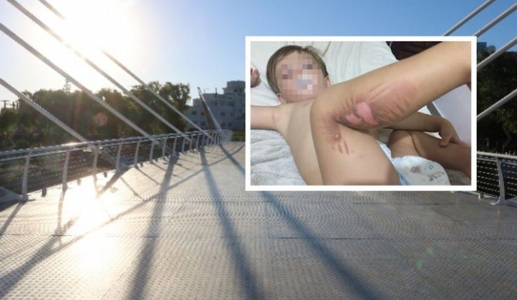 Un niño sufrió quemaduras por tocar el piso del nuevo puente peatonal en Carlos Paz | Actualidad