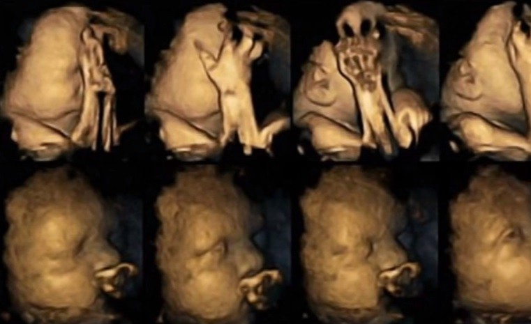 Logran captar la cara de sufrimiento de un feto cuando su madre fuma | Actualidad