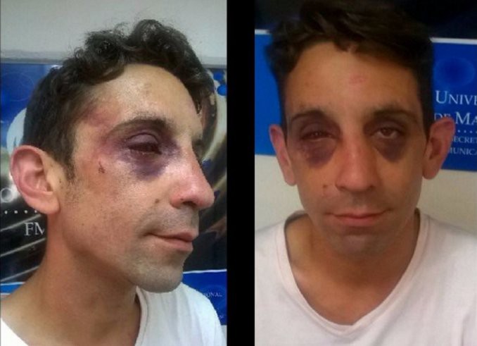 Un joven gay denuncia haber sido salvajemente golpeado por una patota neonazi | Actualidad