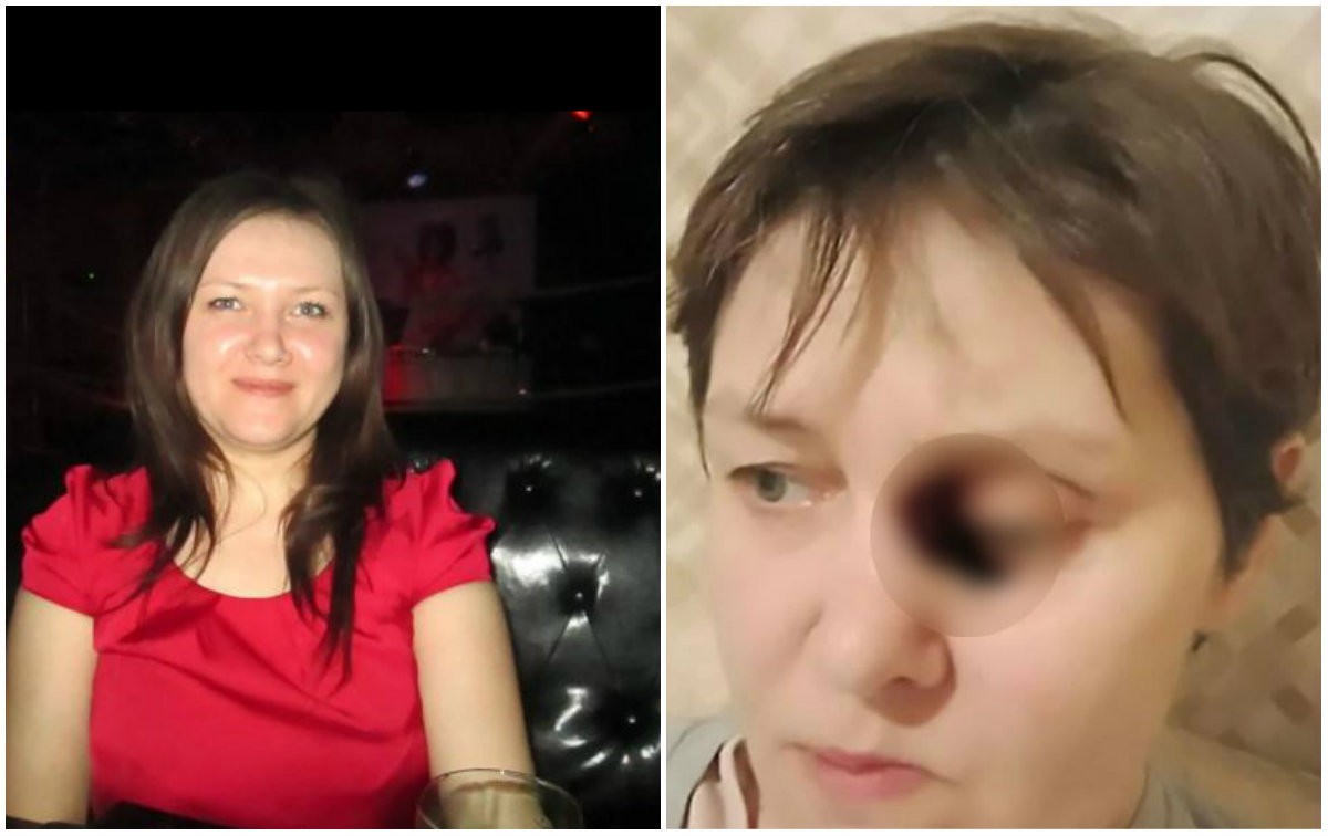 La terrible enfermedad que sufre una mujer: le carcome la cara y no descubren las causas | Curiosidades