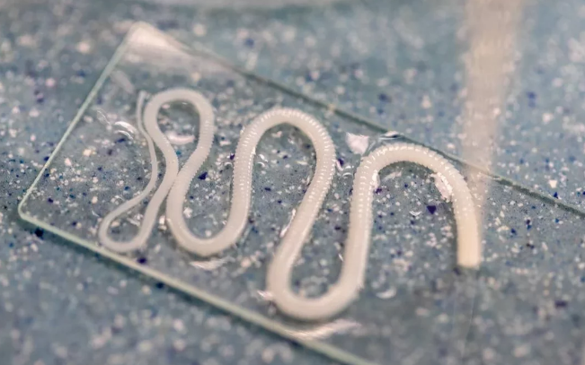 Sufría fuertes dolores de cabeza hasta que le sacaron una lombriz solitaria que tuvo por 10 años | Curiosidades