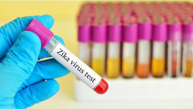 Se estima que en 18 meses comenzarán los ensayos de una vacuna contra el zika | Actualidad