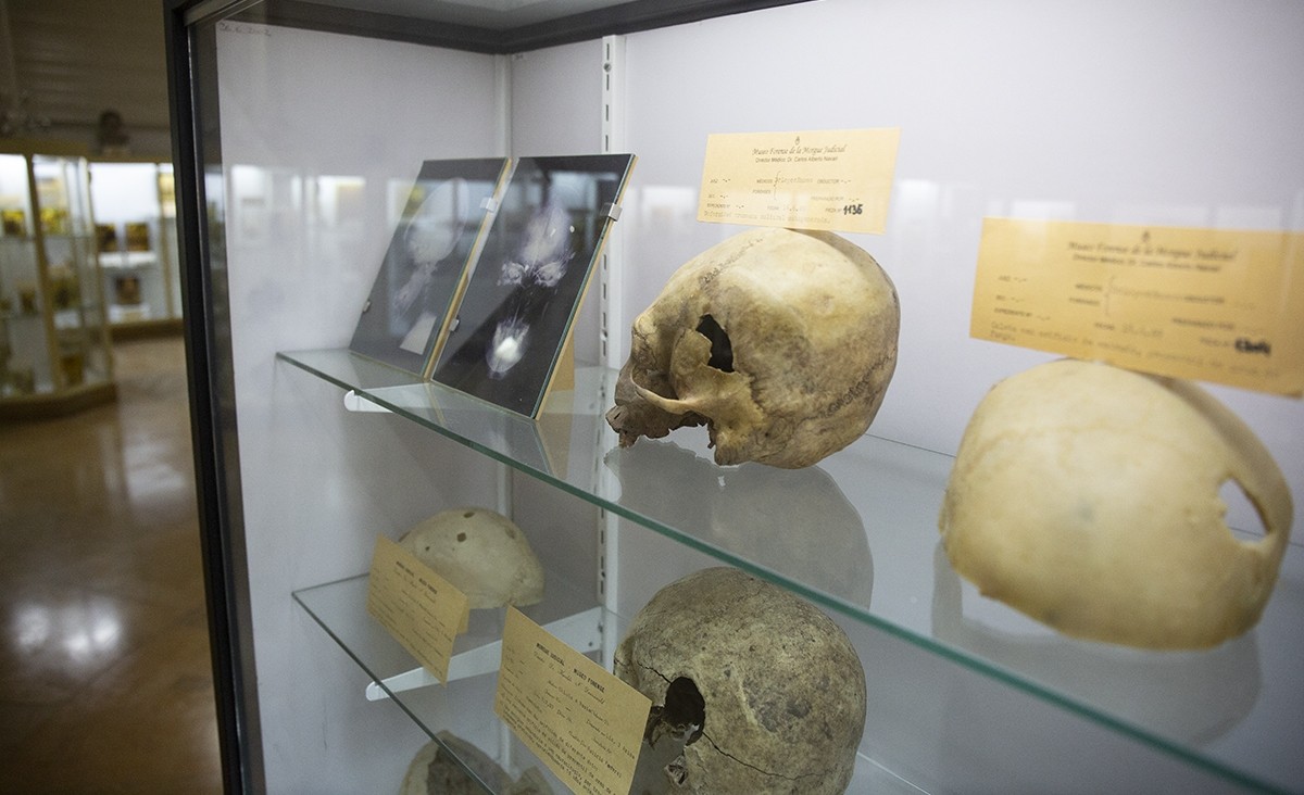El museo que expone restos humanos | Curiosidades