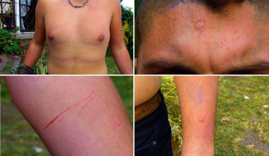 Desvincularán a los tres efectivos de la policía bonaerense que torturaron a un militante LGBT en Miramar | Actualidad