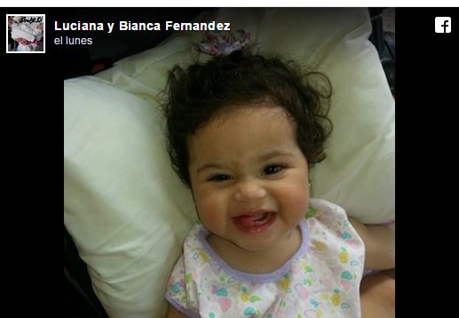 Foto: así está ahora Luciana, la beba siamesa que sobrevivió a la operación | Actualidad