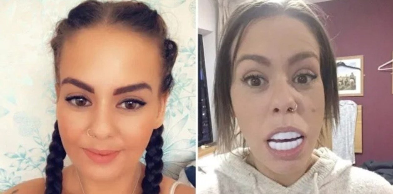 Quería tener una sonrisa perfecta, compró una dentadura por Internet y ahora no puede cerrar la boca | Curiosidades