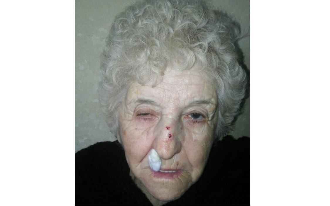 Al denunciar un robo, en la comisaría le pidieron un examen ginecológico y anal | Actualidad