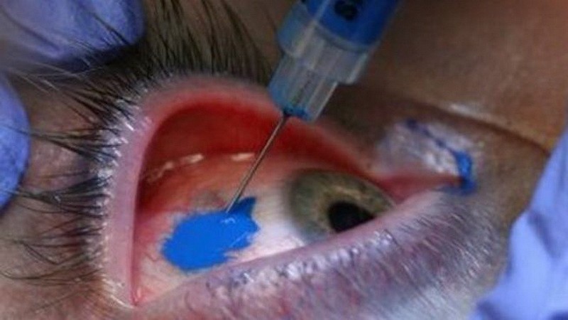 Eyeball y lengua bífida, las señas de una nueva tribu urbana | Actualidad