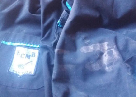 Niño víctima de bullying sufrió traumatismo de cráneo al ser golpeado por compañeros de escuela | Actualidad