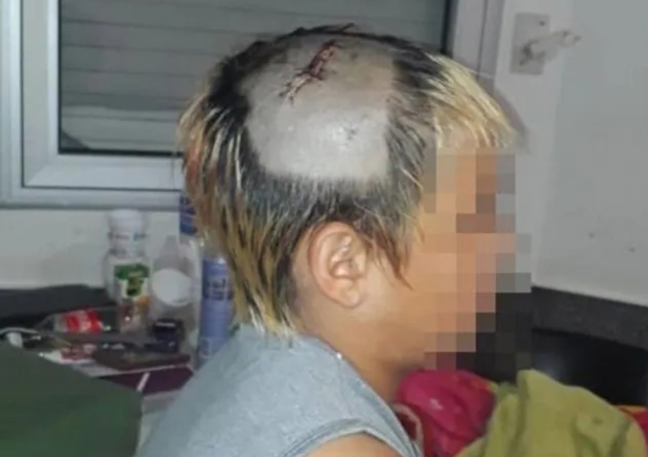 Tres policías fueron detenidos por golpear ferozmente a un chico de 10 años | Actualidad