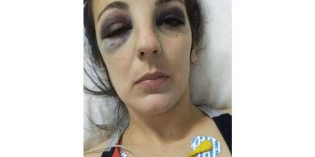 Detuvieron a un futbolista por darle una brutal golpiza a su ex pareja | Actualidad