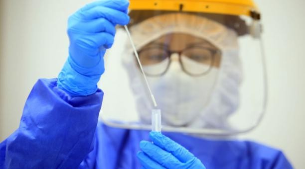 Coronavirus: la Ciudad hará testeos a contactos estrechos a pesar de no tener síntomas | Actualidad