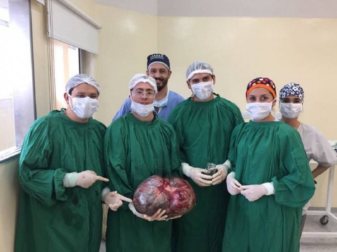 Catamarca: extirparon un tumor de 15 kilos a una mujer | Actualidad