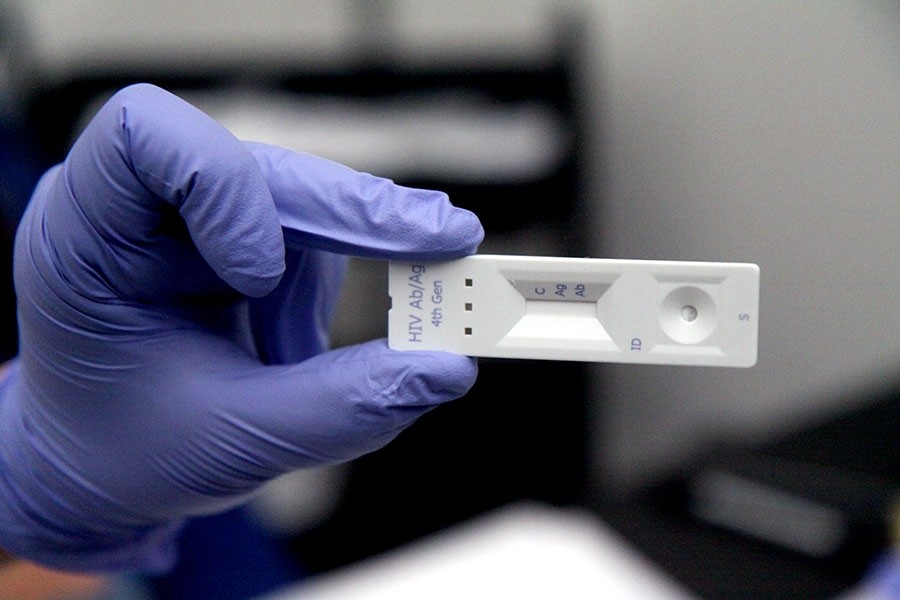 Lanzan manual con estrategias de tests rápidos de VIH y sífilis | Actualidad