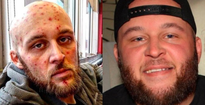 Se recuperó de las drogas, mostró los cambios y se volvió viral | Internacionales