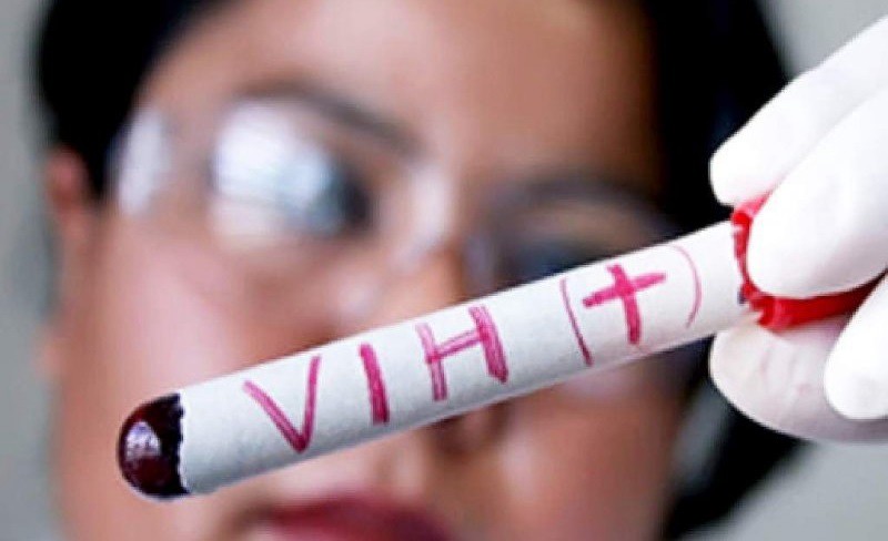 Buscan que más personas se hagan el test de HIV y no se necesitará orden médica en hospitales públicos | Actualidad
