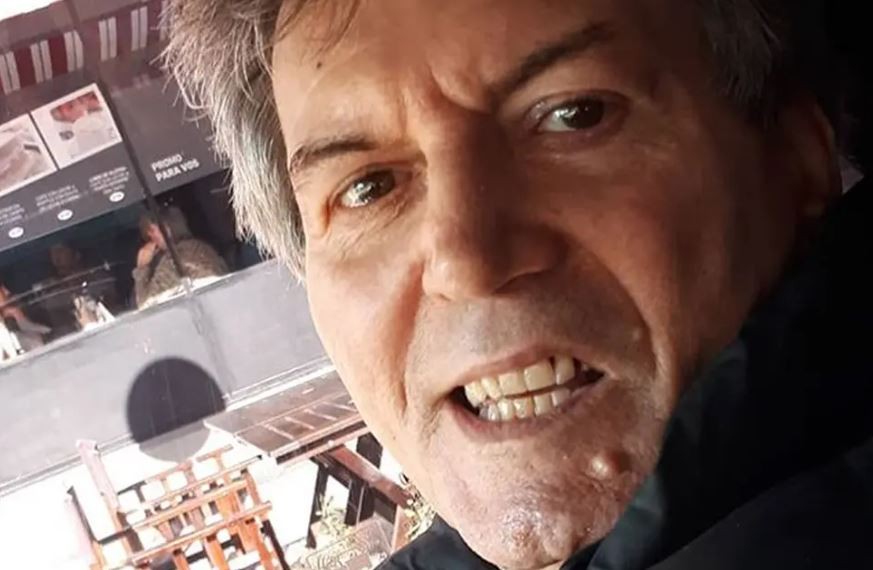 El actor Carlín Calvo fue derivado a un centro de cuidados especiales | Espectáculos