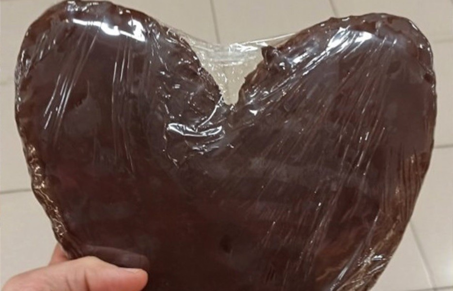 Nutricionista advierte sobre una factura que contiene 2300 kilocalorias | Curiosidades