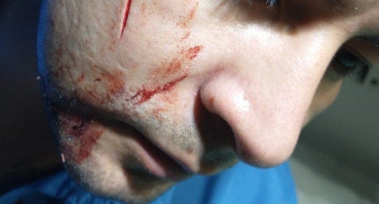 Atacaron a cuchilladas a un colectivero y los choferes reclaman las cabinas blindadas | Actualidad