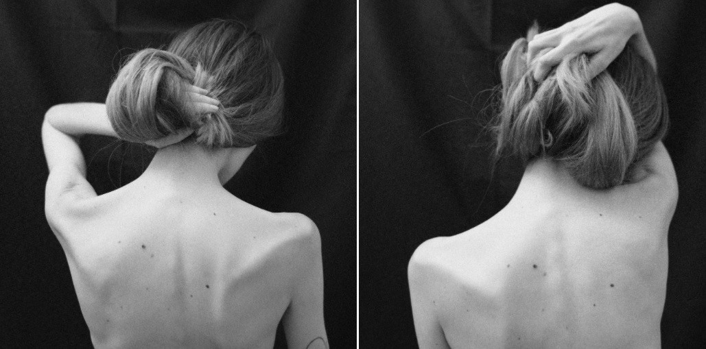 La criticaron y se burlaron en redes sociales por su delgadez: contó que tiene cáncer | Actualidad