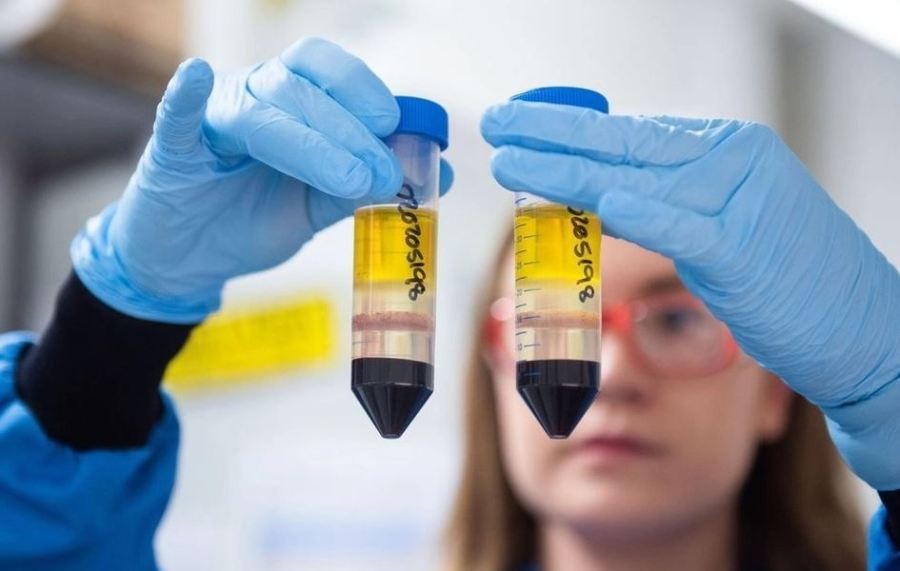 Los ensayos sobre la combinación de las vacunas Sputnik V y AstraZeneca empezarán en Azerbaiyán | Internacionales