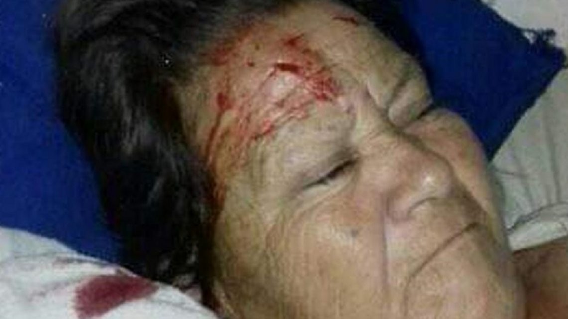 Santiago del Estero: estaba internada en un hospital y le cayó un ventilador de techo en la cara | Actualidad