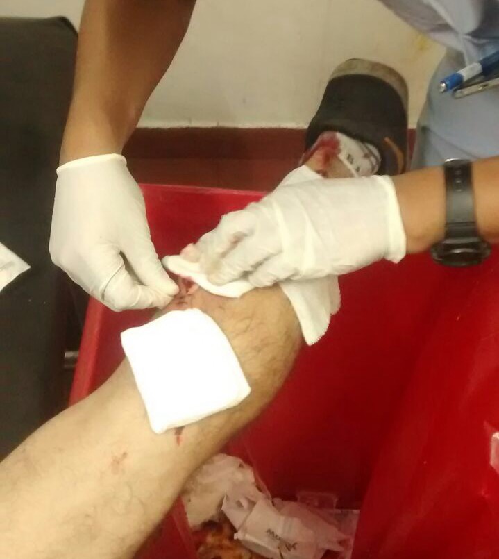 Le cosieron la pierna sobre un tacho de residuos hospitalarios | Actualidad