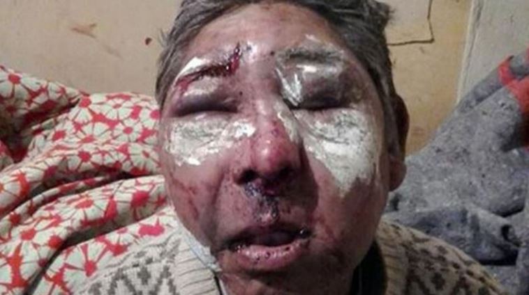 Impactante: lo desfiguraron para robarle un termo, un candado y 60 pesos | Actualidad