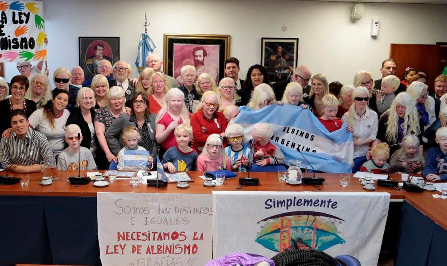 Albinismo: curiosidades, discriminación y un proyecto de ley esperanzador | Actualidad